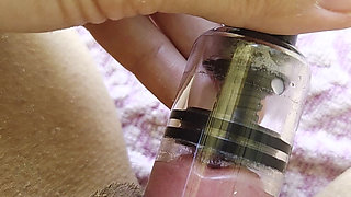 A Swollen Clitoris Looks Even Fleshier up Close