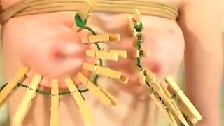 Bdsm Doctor Enjoys Teasing His Patients Tits