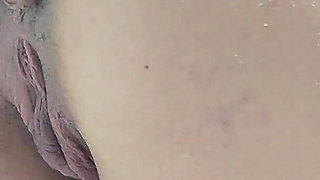 Pissing with a Huge Hemorrhoid in My Asshole Anal Problems