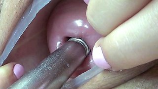 Lesbian piss inside the Uterus of other with tube in PeeHole