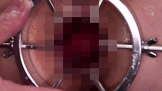 x2xFCFCC5776C9B59886D